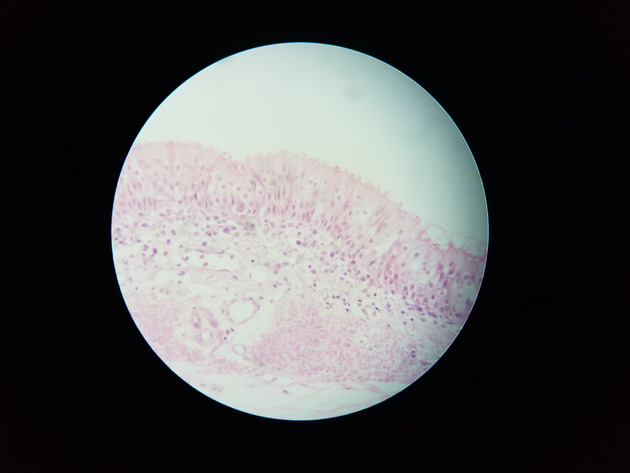 Pseudostratified Epithelium Slides - Pseudostratified Epithelium 01 400X
